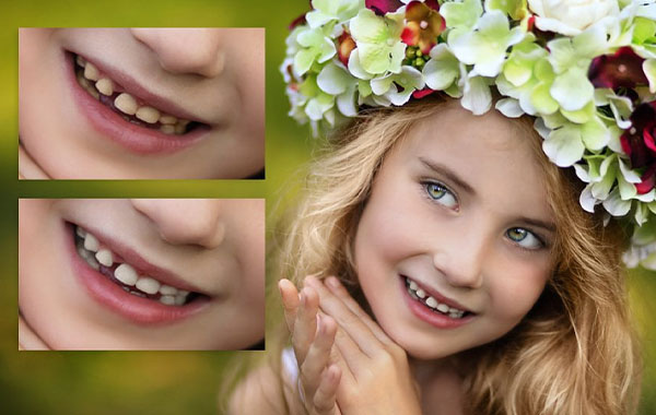 人像笑容微笑后期修饰视频教程-Smile Editing Essentials Workflow – Summerana